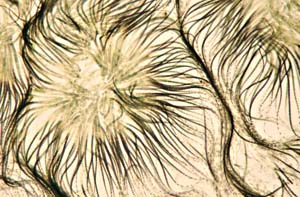 1013CR55-27_Gleotrichia